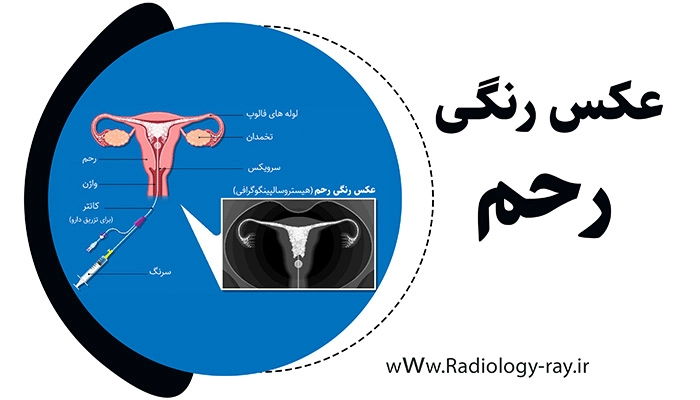 عکس رنگی رحم  یا هیستروسالپنگوگرافی در شهرری 